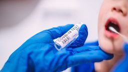 COVID-19 ở trẻ em – Những điều cần biết!