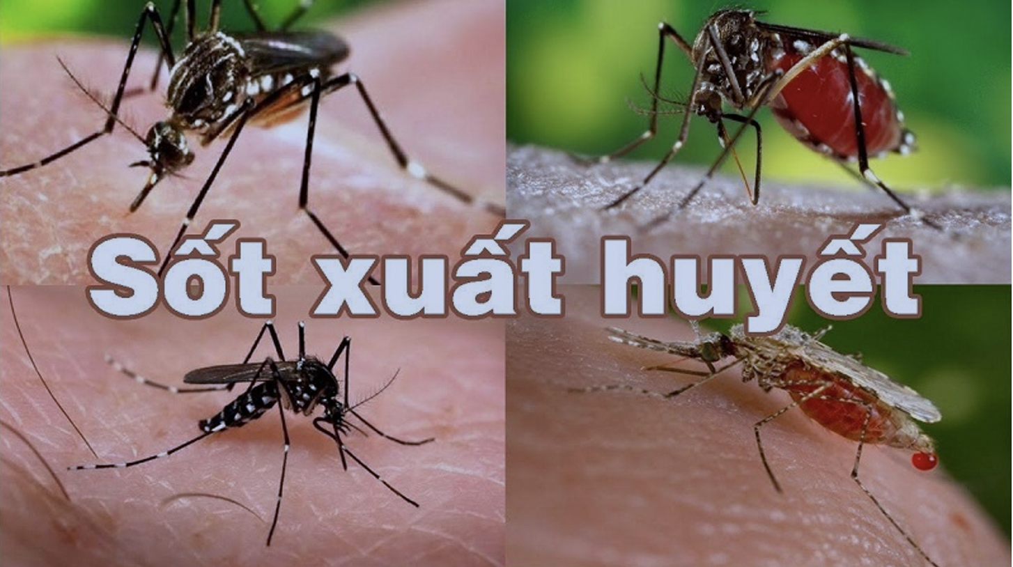 BỆNH SỐT XUẤT HUYẾT Ở TRẺ NHỎ VÀ CÁCH PHÒNG NGỪA