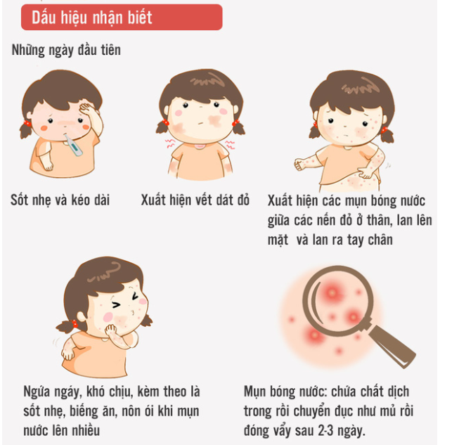 http://ththitranphung.danphuong.edu.vn/upload/29062/20190509/74713423d0d4a21646b7a243cbfb5437dau_hieu_nhan_biet_43201921.png