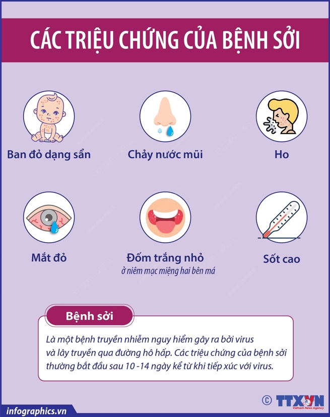 Các triệu chứng của bệnh sởi